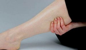 Варикозное расширение вен ног витамины thumbnail